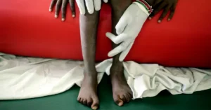 African Christians Advocate for Dignity of Terminally Ill Teens Amid Sickle Cell Challenges
