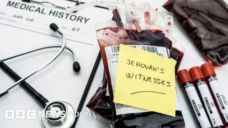 Jehovah’s Witnesses Update Policy to Allow Use of Own Blood for Medical and Surgical Care